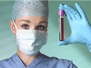Xét nghiệm máu đơn giản dự đoán sớm tái phát ung thư vú