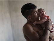 WHO ban bố tình trạng khẩn cấp toàn cầu về virus Zika