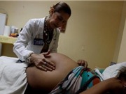 Siêu âm đồng loạt cho bà bầu 3 tháng nếu virus Zika vào Việt Nam