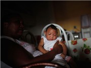 7 bí ẩn chưa thể lý giải về virus gây teo não Zika