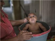 Trung Quốc xác nhận ca nhiễm virus Zika đầu tiên