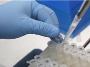 Vắcxin phòng virus Zika sẽ được thử trên người trong năm 2016