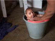 Nghiên cứu vắc xin phòng virus Zika đạt bước tiến mới