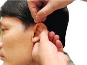 Dấu hiệu trên tai cảnh báo bệnh nan y