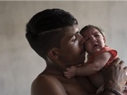 Một người Australia nghi nhiễm virus Zika từ Việt Nam