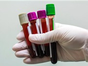 Mùa sinh có liên quan tới bệnh tật