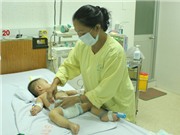 Viêm màng não mô cầu: Dễ phát, nguy hiểm cao