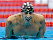 Giác hơi nở rộ tại Olympic, “mê tín” hay khoa học?