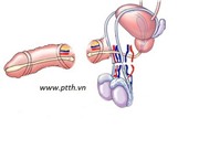 Việt Nam: Lần đầu nối ghép thành công hai tinh hoàn đứt rời cùng dương vật