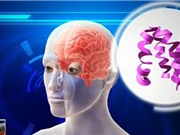 Ô nhiễm không khí làm tăng nguy cơ mắc Alzheimer