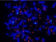 Phát hiện mới: Gene ung thư có thể tồn tại bên ngoài nhiễm sắc thể