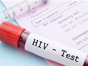 Tìm ra phương pháp xét nghiệm HIV mới cho kết quả nhanh nhất