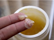 Những thành phần đánh lừa cảm giác đau trong cao hổ