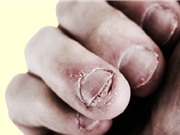 7 điều xảy ra khi bạn cắn móng tay