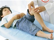 Viêm khớp mạn tính tuổi thiếu niên