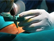 Việt Nam ứng dụng thành công kỹ thuật ghép tế bào gốc giá rẻ