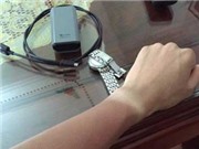 Da bị cháy nắng, có nên “tắm trắng”?