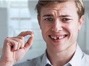 Vì sao răng chưa già đã rụng?