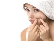 Một số cách trị mụn bọc bằng phương pháp tự nhiên ngay tại nhà