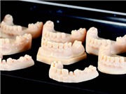 Công nghệ in 3D giúp được gì cho nha khoa?