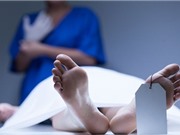 Những biến đổi kỳ lạ của cơ thể người sau khi chết