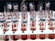 Một xét nghiệm máu có thể phát hiện tám bệnh ung thư