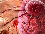 Phát hiện 2 protein ở da người tự hủy tế bào ung thư