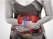 Sử dụng kháng sinh đường uống làm tăng nguy cơ bị sỏi thận?