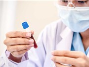 Xét nghiệm phát hiện 10 loại ung thư nhiều năm trước khi bệnh