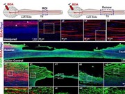Nghiên cứu phương pháp phục hồi chấn thương cột sống cấp tính ở khỉ