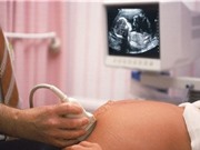 Bỗng xuất hiện chấm đen bí ẩn trong bụng nhiều thai phụ