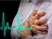 Phân tích hình ảnh chụp CT giúp cảnh báo sớm bệnh đau tim