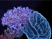 Phát hiện chất điều trị bệnh Alzheimer trong loài hải quỳ