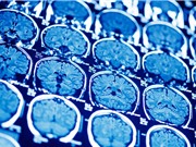 Xây dựng mô hình gene não người
