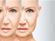 Phụ nữ sống thọ hơn đàn ông là nhờ có 2 nhiễm sắc thể X?
