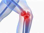 Bào chế được vắc xin giúp giảm đau do viêm xương khớp
