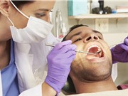 Giảm nguy cơ ung thư vòm miệng nhờ chỉ nha khoa