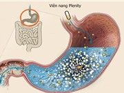 Viên nang giúp giảm cân và điều trị béo phì