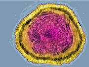 Virus, không phải vi khuẩn, gây nhiều ca bệnh viêm phổi ở trẻ em