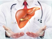 Người không uống rượu vẫn có nguy cơ mắc bệnh gan do cồn 