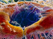 Lần đầu triển khai kỹ thuật chỉnh sửa gen CRISPR-Cas9 trực tiếp trong cơ thể người