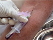 Xét nghiệm máu có thể dò được ung thư nhiều năm trước khi có triệu chứng