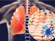 Đại dịch covid-19: Quá ngẫu nhiên để đoán định?