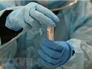 Dịch COVID-19: Thụy Sĩ phát hiện virus SARS-CoV-2 trong da người
