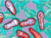 Ngộ độc thực phẩm Botulinum