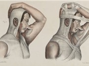 Lược sử phẫu thuật thẩm mỹ
