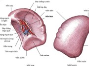 Bệnh viện Nhân dân Gia Định điều trị vỡ lá lách bằng phương pháp làm tắc mạch 