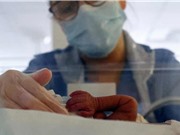 Nghe giọng nói của mẹ có thể làm giảm đau ở trẻ sinh non