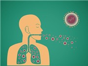 Số ca tử vong do bệnh lao trên toàn cầu có xu hướng gia tăng
