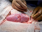 Chưa thể cấy ghép nội tạng từ động vật sang người